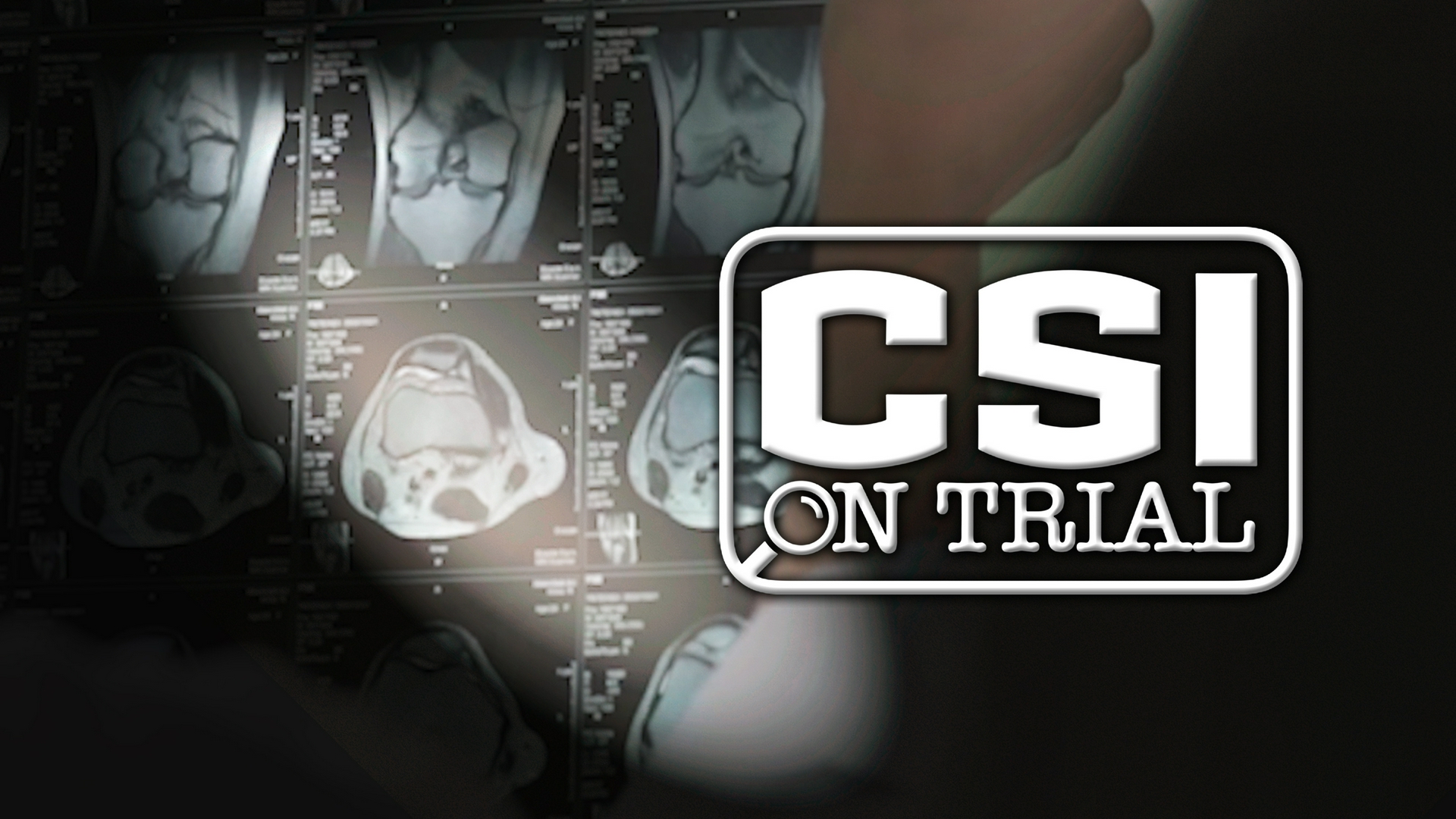 El síndrome del bebé sacudido